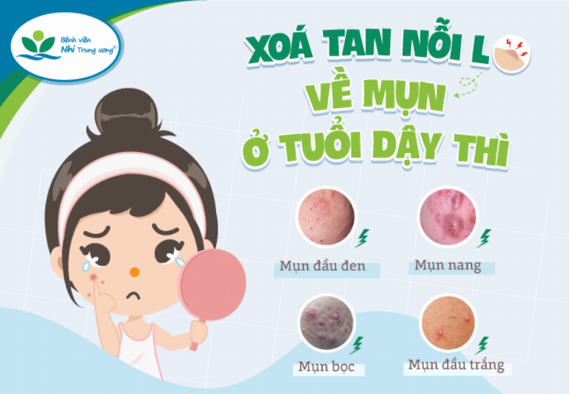 Chăm sóc da chuyên sâu tuổi dậy thì