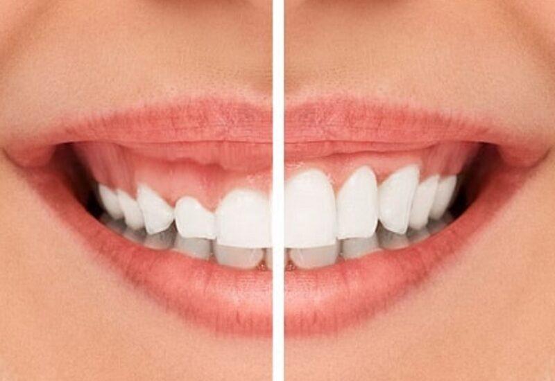 Các yếu tố ảnh hưởng đến chi phí của bó hoa cưới và khoảng giá tham khảo