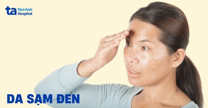 Hinh anh vung da co bi gai den day sung kem theo cac cach khac phuc tai nha