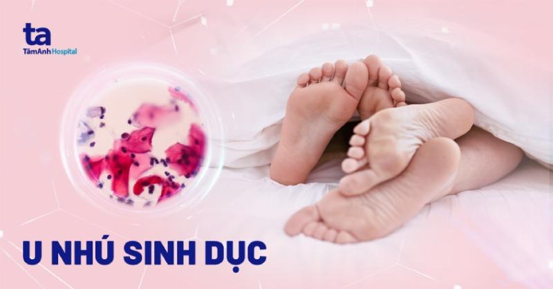 Minh hoa viec kham bac si chuyen khoa de chan doan mun gai sinh duc nam