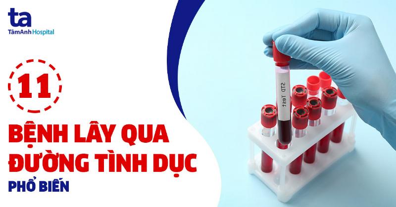 Diagram so sanh hinh anh mun gai sinh duc voi sui mao ga va mun rop sinh duc