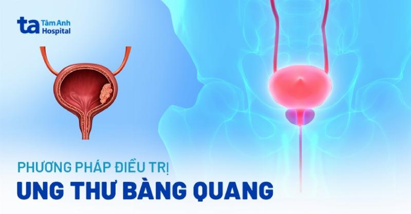 Một người đang cẩn thận cắt gốc hoa và đặt vào bình nước có dưỡng chất, minh họa quy trình chăm sóc hoa tươi để kéo dài tuổi thọ, thể hiện sự tỉ mỉ khác biệt với việc chỉ hỏi cà rốt bao nhiêu 1kg.