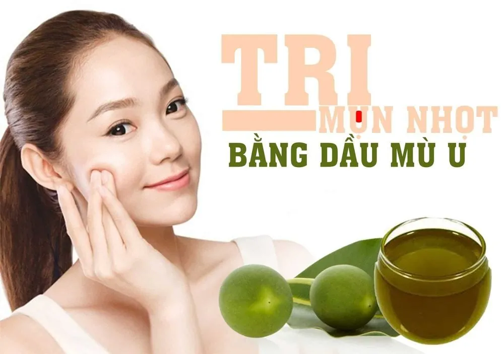 Dầu mù u hỗ trợ điều trị mụn trứng cá và mụn nhọt trên da hiệu quả