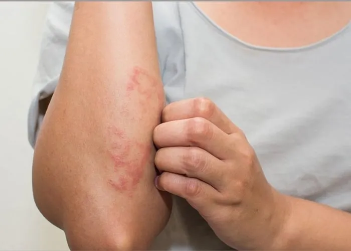 Tác hại khi dùng phải nước hoa fake
