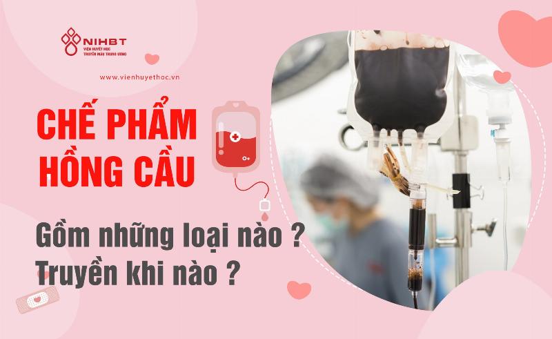 Hoa hồng có bao nhiêu màu: Chọn và bảo quản