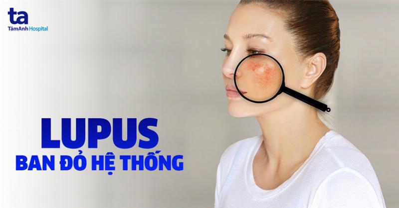 Hinh anh tulip trong binh tiep tuc dai ra va uon luon